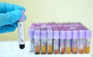 เข้าใจ โรคเอดส์ (AIDS) อาการและการป้องกัน โรคเอดส์