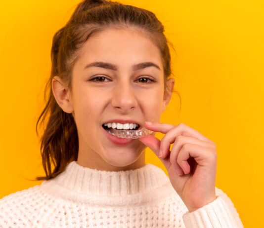 รู้จัก Selfie นวัตกรรมจัดฟัน clear aligner ราคาถูก สะดวก ทำได้ที่บ้าน จัดฟัน clear aligner ราคาถูก